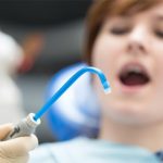 ساکشن دندانپزشکی چیست؟