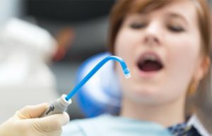 ساکشن دندانپزشکی چیست؟